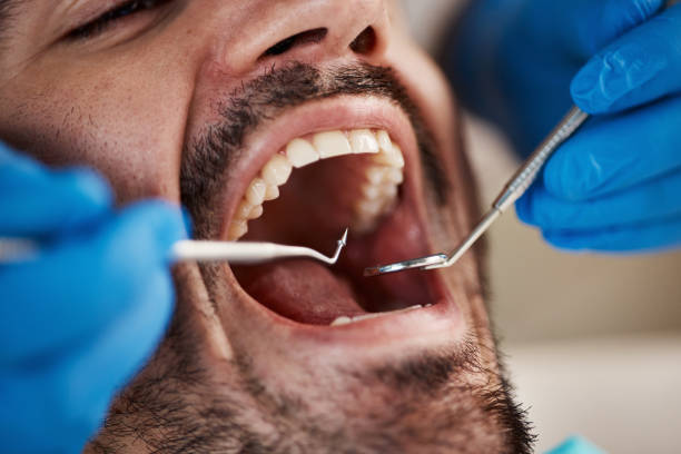 Best Emergency Dentist for Lost Fillings or Crowns in Westport Village, CT