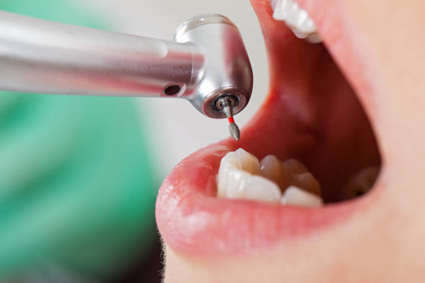 Best Weekend Emergency Dentist in Westport Village, CT